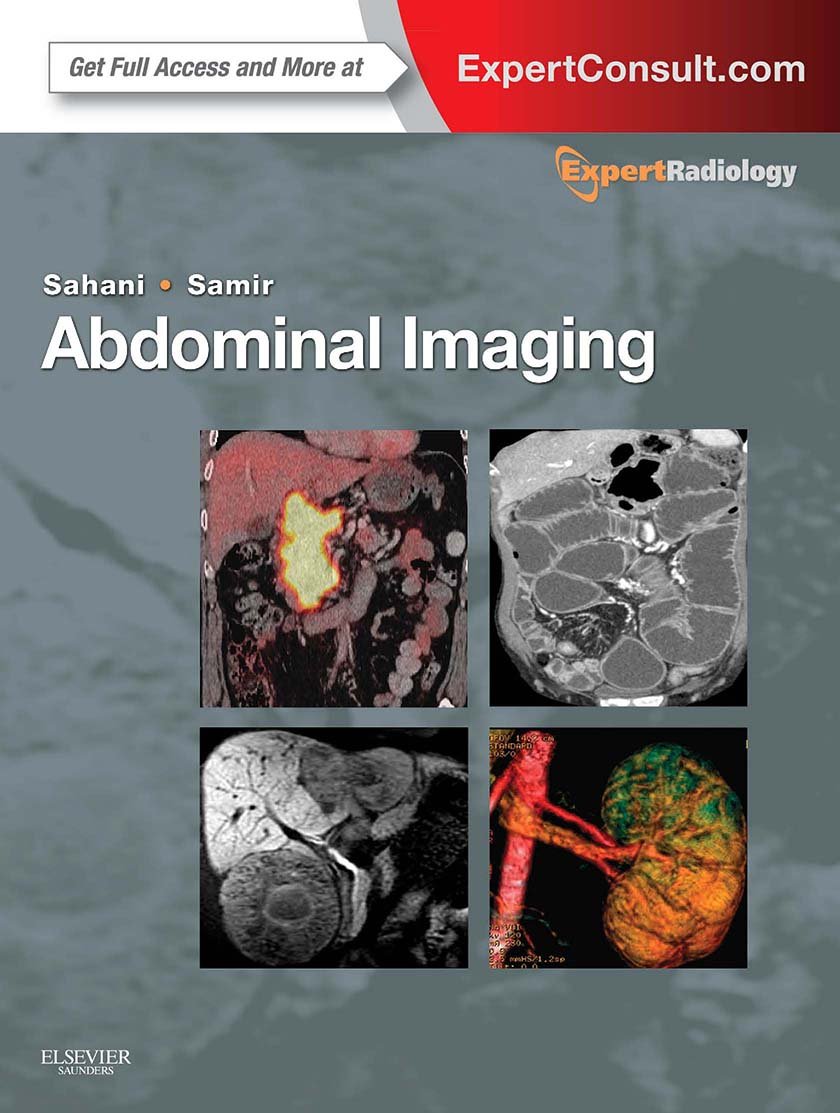 Buy Abdominal Imaging, 2-Volume Set: Expert Radiology Series
